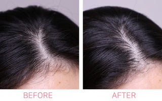 AROMATICA Rosemary Active V Anti-Hair Loss Tonic